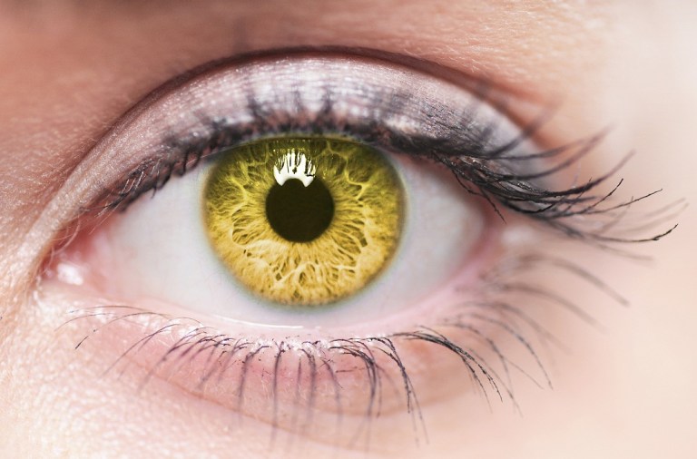 Get Rid of Yellow Eyes Using  Natural Remedies