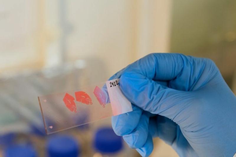 Новосибирские учёные запатентовали средство, усиливающее лекарство от рака